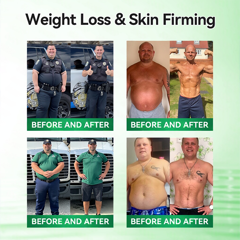 Official Store | ⏰ 𝐒𝐥𝐢𝐦𝐨𝐥𝐲™ 12-IN-1 Moringa * Berberine * NAD+ Advanced Nano Microneedle Patch (Once Daily, visible changes in 7 days) For Obesity, Loose Skin, Diabetes, Sleep Apnea, And Joint Issues 🎀