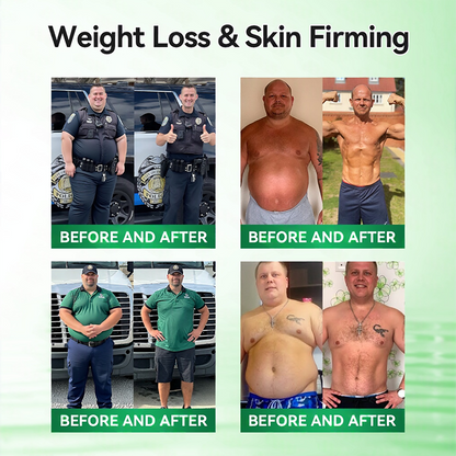 Official Store | ⏰ 𝐒𝐥𝐢𝐦𝐨𝐥𝐲™ 12-IN-1 Moringa * Berberine * NAD+ Advanced Nano Microneedle Patch (Once Daily, visible changes in 7 days) For Obesity, Loose Skin, Diabetes, Sleep Apnea, And Joint Issues 🎀